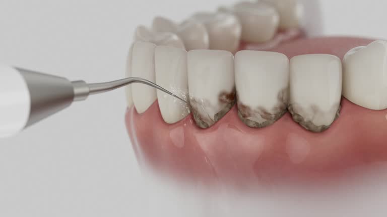Reliable Dental contractor in Laramie, WY by Dentist Open Now